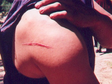 Mmm. Wounded flesh.